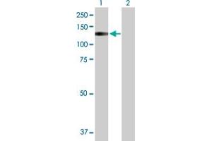 Western Blotting (WB) image for TRPA1 293T Cell Transient Overexpression Lysate(Denatured) (ABIN1334350)