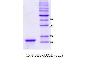 Figure annotation denotes ug of protein loaded and % gel used. (alpha Synuclein 112 (NACP112) (active) 蛋白)