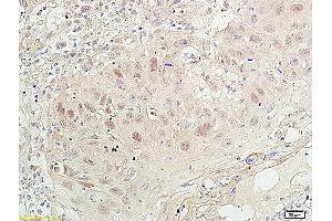 Immunohistochemistry (IHC) image for anti-Proliferating Cell Nuclear Antigen (PCNA) (AA 151-261) antibody (ABIN676583)