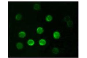 Immunofluorescence analysis of B lymphocytes using CD20 mouse mAb. (CD20 抗体)