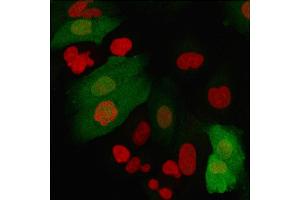 Immunofluorescence (IF) image for anti-S100 Calcium Binding Protein A4 (S100A4) (AA 1-200) antibody (ABIN6940545)