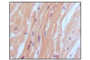 Immunohistochemical analysis of paraffin-embedded human normal myocardium, showing cytoplasmic localization using BNP2 antibody with DAB staining. (BNP 抗体)