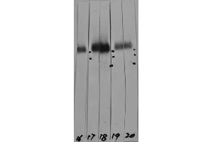 Western strip blots of HeLa cell crude extracts with two different preparations of ABIN1580432 in strips 17 and 18. (LAMP1 抗体)