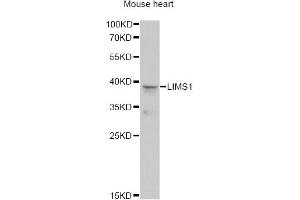 Western blot analysis of extracts of mouse heart, using LIMS1 antibody. (LIMS1 抗体)