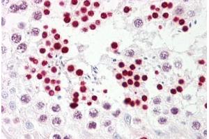 Anti-p53 antibody IHC staining of human testis. (p53 抗体  (AA 344-393))