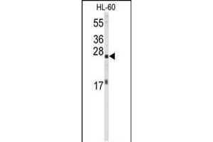 Western blot analysis of EIF4E Antibody in HL-60 cell line lysates (35ug/lane) (EIF4E 抗体)
