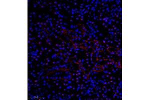 Immunofluorescence of paraffin embedded mouse nephritis using pax2 (ABIN7074974) at dilution of 1:600 (300x lens) (PAX2A 抗体)