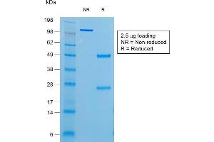 SDS-PAGE Analysis of Purified Thyroglobulin Mouse Recombinant Monoclonal Antibody (r6E1). (Recombinant Thyroglobulin 抗体)