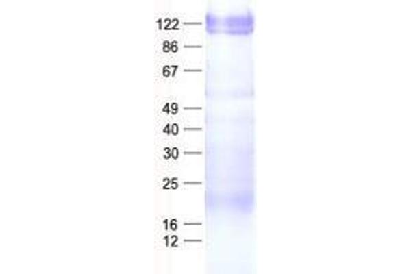 ZNF274 Protein (His tag)