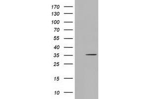 HEK293T cells were transfected with the pCMV6-ENTRY control (Left lane) or pCMV6-ENTRY SDR9C7 (Right lane) cDNA for 48 hrs and lysed. (SDR9C7 抗体)