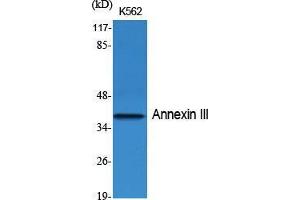 Western Blot (WB) analysis of specific cells using Annexin III Polyclonal Antibody. (Annexin A3 抗体  (Internal Region))