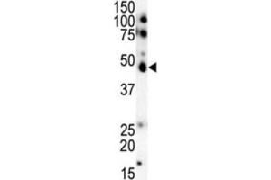 Western Blotting (WB) image for anti-Casein Kinase 1, epsilon (CSNK1E) antibody (ABIN3003191) (CK1 epsilon 抗体)