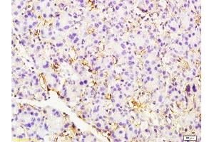 Immunohistochemistry (Paraffin-embedded Sections) (IHC (p)) image for anti-Endoglin (ENG) (AA 58-110) antibody (ABIN707561)