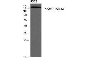 Western Blot (WB) analysis of K562 using p-SMC1 (S966) antibody. (SMC1A 抗体  (pSer966))
