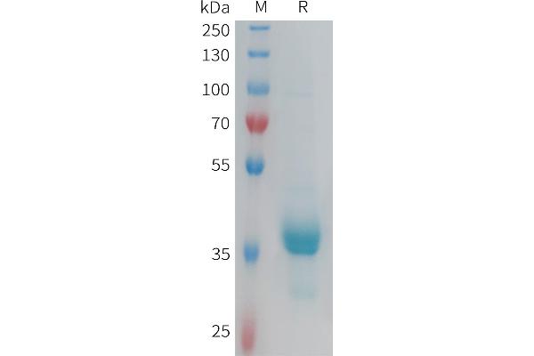 CX3CR1 Protein (AA 1-31) (Fc Tag)