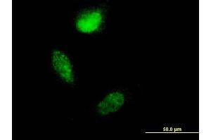 Immunofluorescence (IF) image for anti-S100 Calcium Binding Protein A4 (S100A4) (AA 1-101) antibody (ABIN562767)