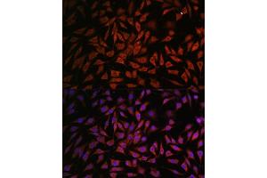 Immunofluorescence analysis of L929 cells using NOB1 antibody (ABIN7270109) at dilution of 1:100. (NOB1 抗体  (AA 1-230))