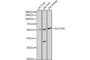 Western blot analysis of extracts of various cell lines, using SLC22 antibody (ABIN3022596, ABIN3022597, ABIN3022598 and ABIN6218932) at 1:1000 dilution. (SLC22A6 抗体)