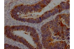 Immunohistochemistry (IHC) image for anti-Galectin 3 (LGALS3) antibody (ABIN7127508)