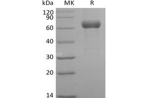 ANGPTL3 Protein (Fc Tag)