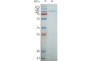 Human R2-Nanodisc, Flag Tag on SDS-PAGE (TAS1R2 蛋白)