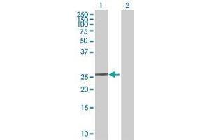 Lane 1: RPP40 transfected lysate ( 26. (RPP40 293T Cell Transient Overexpression Lysate(Denatured))