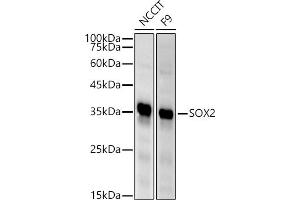 Western blot analysis of extracts of various cell lines, using SOX2 antibody (ABIN6130648, ABIN6148295, ABIN6148297 and ABIN6215241) at 1:500 dilution. (SOX2 抗体  (AA 1-140))