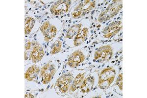 Immunohistochemistry of paraffin-embedded human stomach using SERPINB5 Antibody (ABIN6292701) at dilution of 1:200 (40x lens). (SERPINB5 抗体)