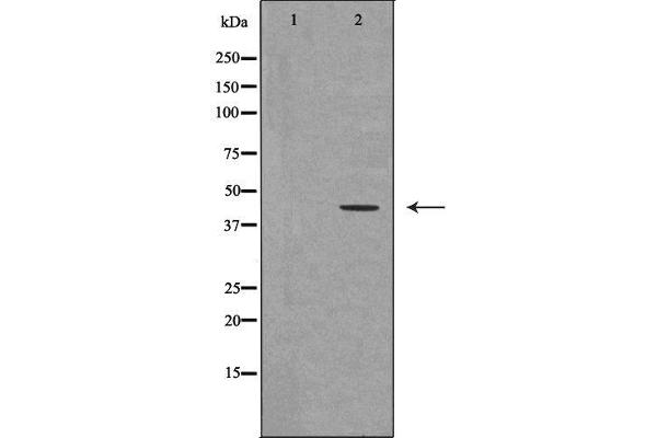 UTS2R 抗体  (C-Term)