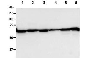 The Cell lysates (40ug) were resolved by SDS-PAGE, transferred to PVDF membrane and probed with anti-human PGM1 antibody (1:1000). (Phosphoglucomutase 1 抗体)