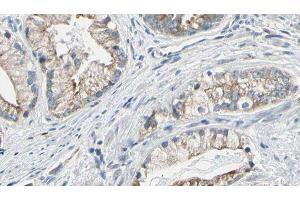 ABIN6277747 at 1/100 staining Human prostate tissue by IHC-P. (IRS2 抗体  (C-Term))