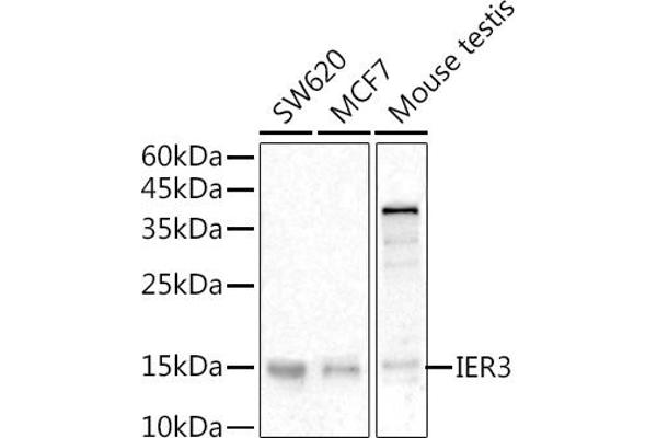 IER3 抗体  (C-Term)
