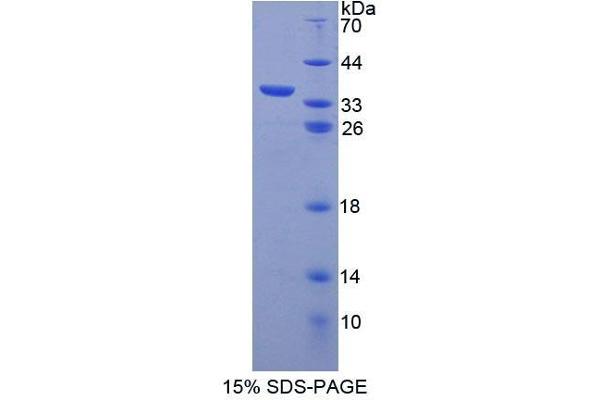 ABCB7 Protein (AA 472-752) (T7 tag,His tag)