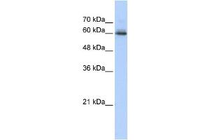 WB Suggested Anti-SEMA4F Antibody Titration:  0. (SEMA4F 抗体  (N-Term))