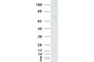 Validation with Western Blot (EEF2K Protein (Myc-DYKDDDDK Tag))