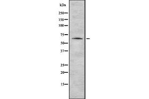 Western blot analysis of K2C1 expression in HEK293 cells ,The lane on the left is treated with the antigen-specific peptide. (Cytokeratin 1 抗体  (N-Term))