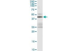 Immunoprecipitation of STK19 transfected lysate using anti-STK19 monoclonal antibody and Protein A Magnetic Bead , and immunoblotted with STK19 MaxPab rabbit polyclonal antibody. (STK19 抗体  (AA 255-364))