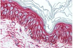 Human Skin (formalin-fixed, paraffin-embedded) stained with CD9 antibody ABIN241562 at 10 ug/ml followed by biotinylated anti-mouse IgG secondary antibody ABIN481714, alkaline phosphatase-streptavidin and chromogen. (CD9 抗体)