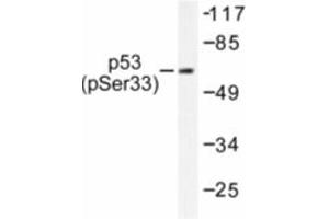 Image no. 1 for anti-Tumor Protein P53 (TP53) (pSer33) antibody (ABIN318093) (p53 抗体  (pSer33))