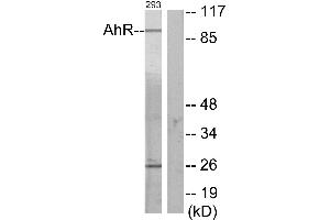 Immunohistochemistry analysis of paraffin-embedded human thyroid gland tissue using AhR (Ab-36) antibody. (Aryl Hydrocarbon Receptor 抗体)