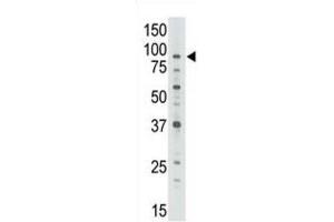 Western Blotting (WB) image for anti-ATP-Binding Cassette, Sub-Family B (MDR/TAP), Member 7 (ABCB7) antibody (ABIN3002511) (ABCB7 抗体)