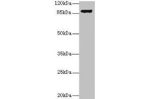 Western blot All lanes: Itgb1 antibody at 16 μg/mL + U87 whole cell lysate Secondary Goat polyclonal to rabbit IgG at 1/10000 dilution Predicted band size: 89 kDa Observed band size: 89 kDa (ITGB1 抗体  (AA 21-728))
