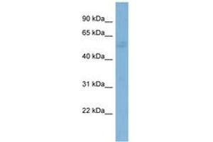 Image no. 1 for anti-GTPase Activating Protein (SH3 Domain) Binding Protein 1 (G3BP1) (AA 107-156) antibody (ABIN6742009) (G3BP1 抗体  (AA 107-156))