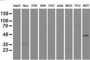 Western blot analysis of extracts (35 µg) from 9 different cell lines by using anti-CD4 monoclonal antibody. (CD4 抗体)