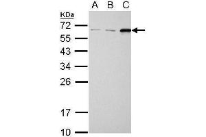 Western Blotting (WB) image for anti-Sequestosome 1 (SQSTM1) antibody (ABIN2854836)