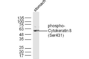 Mouse stomach lysates probed with Cytokeratin 8 (Ser431) Polyclonal Antibody, Unconjugated  at 1:300 dilution and 4˚C overnight incubation. (KRT8 抗体  (pSer431))