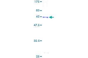 Image no. 1 for Iduronate 2-Sulfatase (IDS) (AA 1-312) protein (GST tag) (ABIN1307390) (IDS Protein (AA 1-312) (GST tag))