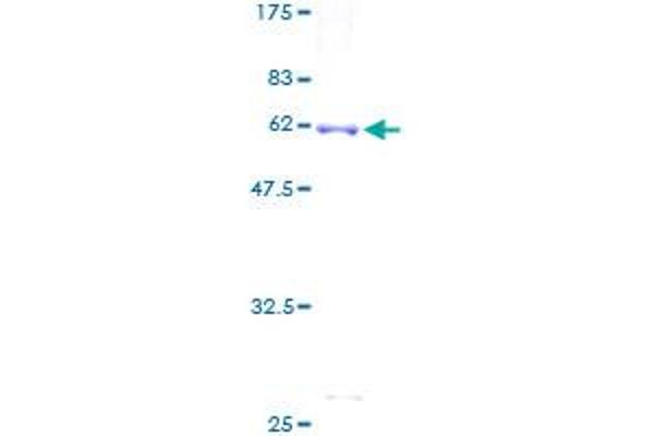 IDS Protein (AA 1-312) (GST tag)