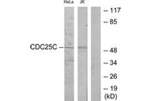 Western Blotting (WB) image for anti-Cell Division Cycle 25 Homolog C (S. Pombe) (CDC25C) (AA 183-232) antibody (ABIN2888961) (CDC25C 抗体  (AA 183-232))