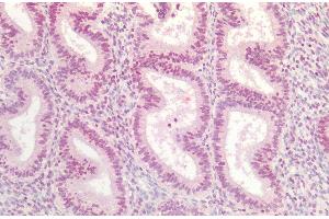 Immunohistochemistry analysis using Rabbit Anti-AKT1 Polyclonal Antibody (ABIN5667429). (AKT1 抗体  (AA 100-200) (HRP))